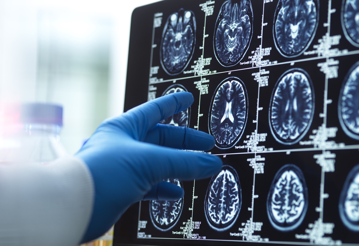 1 de 1 Foto de mão de médico segurando exame de imagem do cérebro - Geriatra lista 5 melhores ...