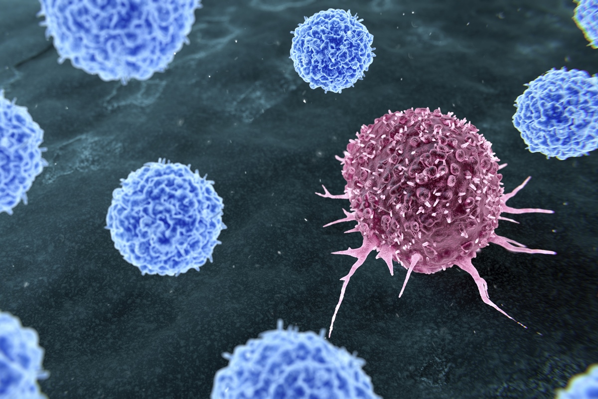 1 de 1 Ilustração representando a terapia com linfócitos infiltrantes de tumor (TIL) para o tr...