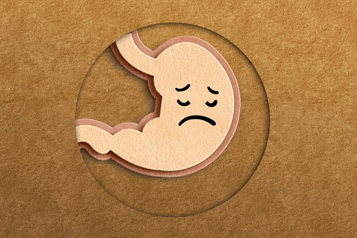 1 de 1 Imagem conceitual de um estômago feito de feltro com uma carinha triste. Dor de estômago...