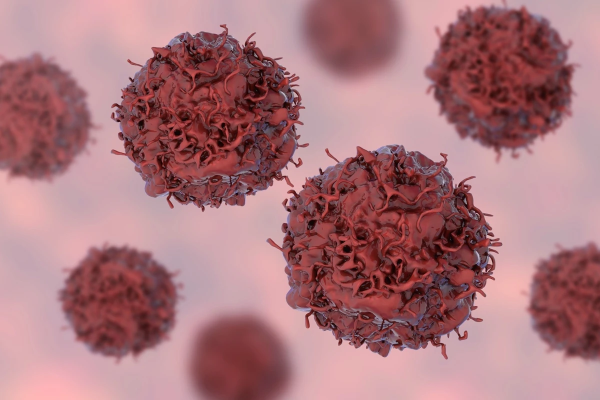 1 de 1 Ilustração colorida de células cancerígenas - 40% dos casos de câncer poderiam ser ev...