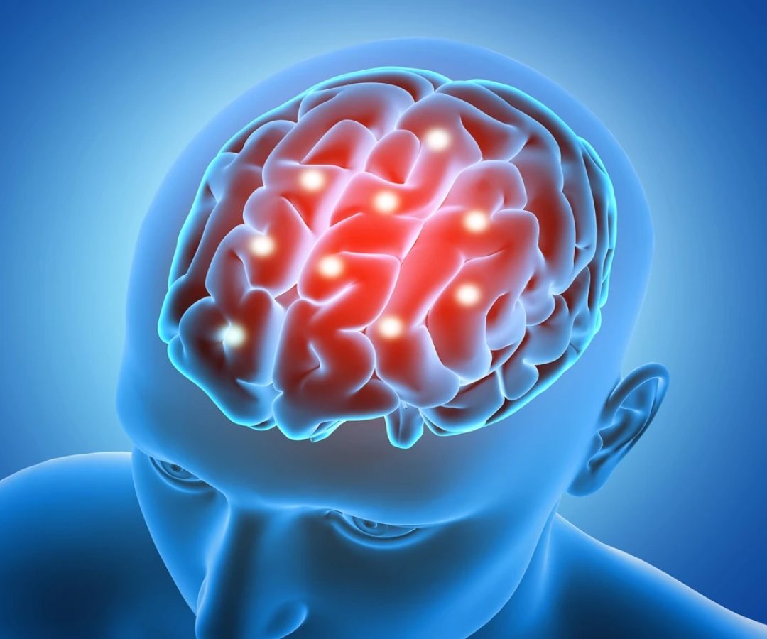 1 de 1 Cérebro com pontos destacados- Metrópoles - Foto: Freepik