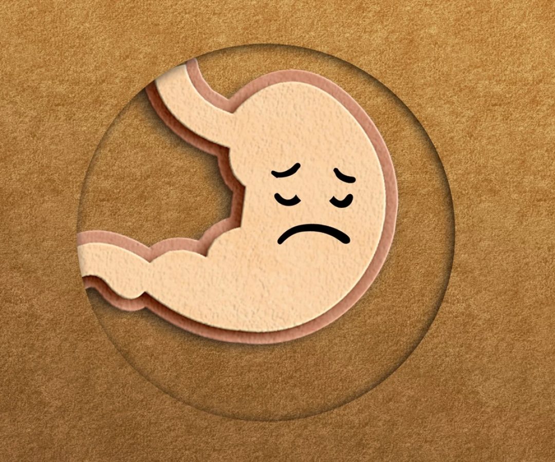 1 de 1 Imagem conceitual de um estômago feito de feltro com uma carinha triste. Dor de estômago...