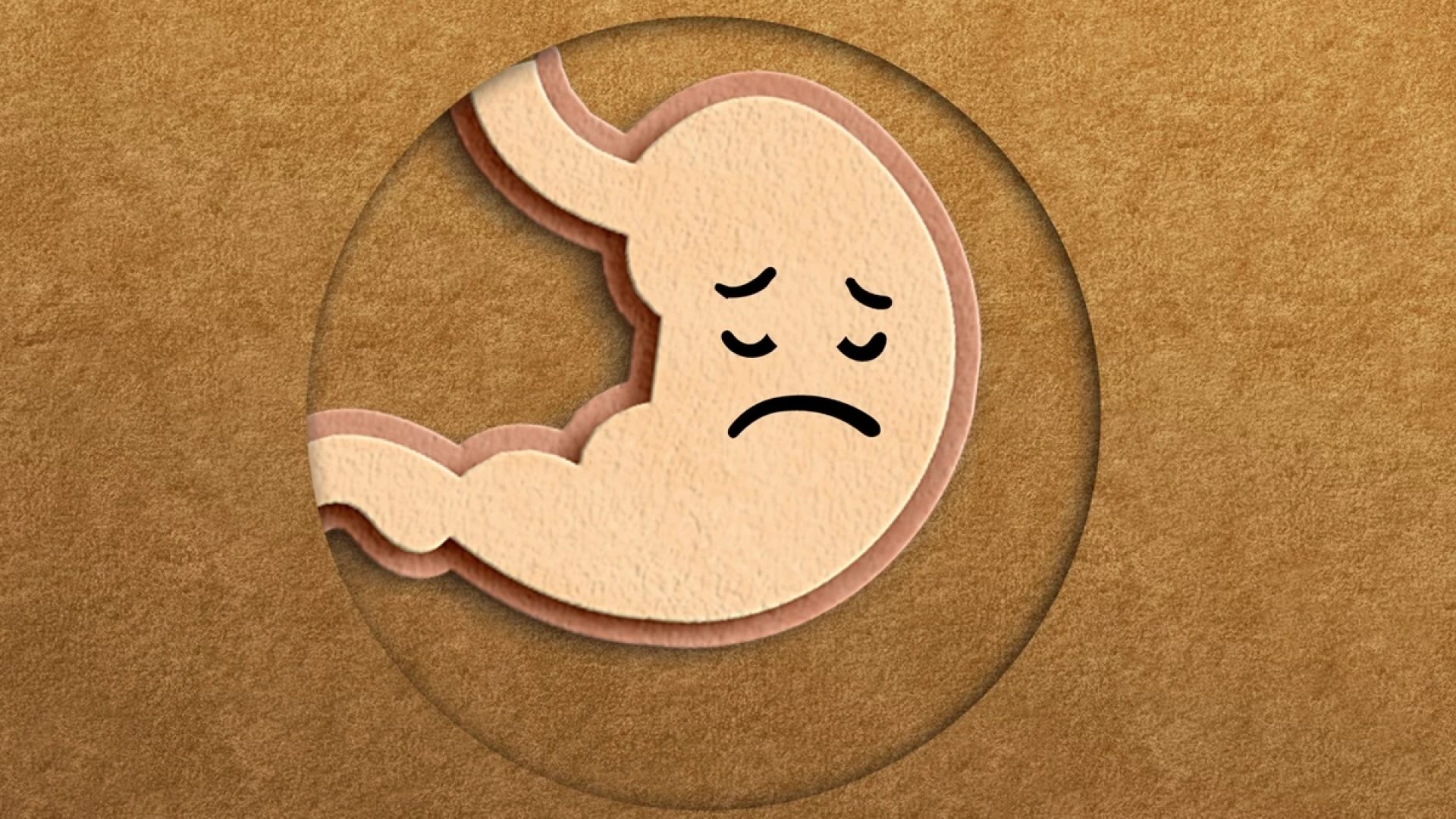 1 de 1 Imagem conceitual de um estômago feito de feltro com uma carinha triste. Dor de estômago...