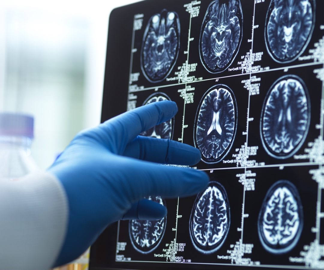 1 de 1 Foto de mão de médico segurando exame de imagem do cérebro - Geriatra lista 5 melhores ...