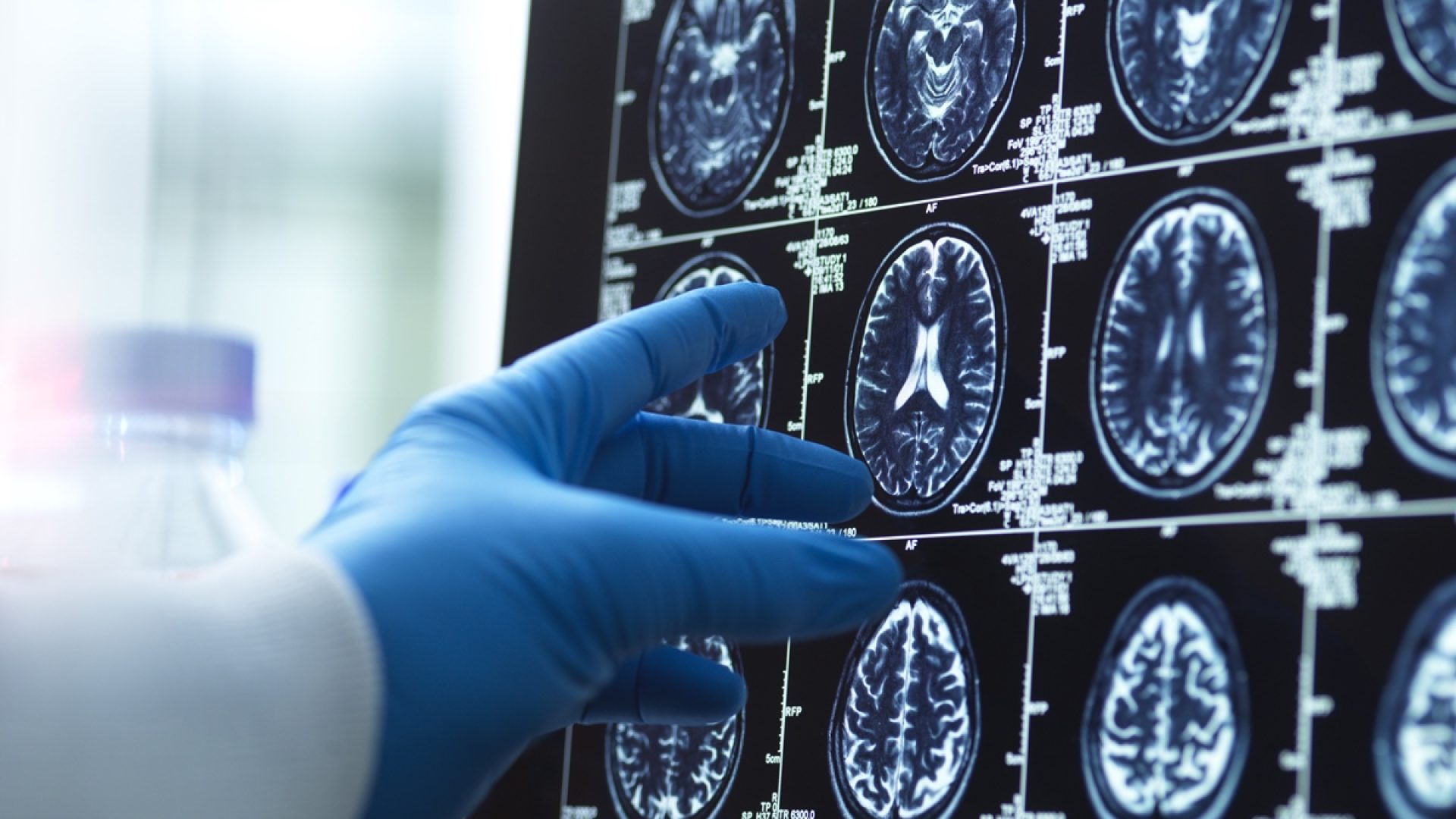 1 de 1 Foto de mão de médico segurando exame de imagem do cérebro - Geriatra lista 5 melhores ...