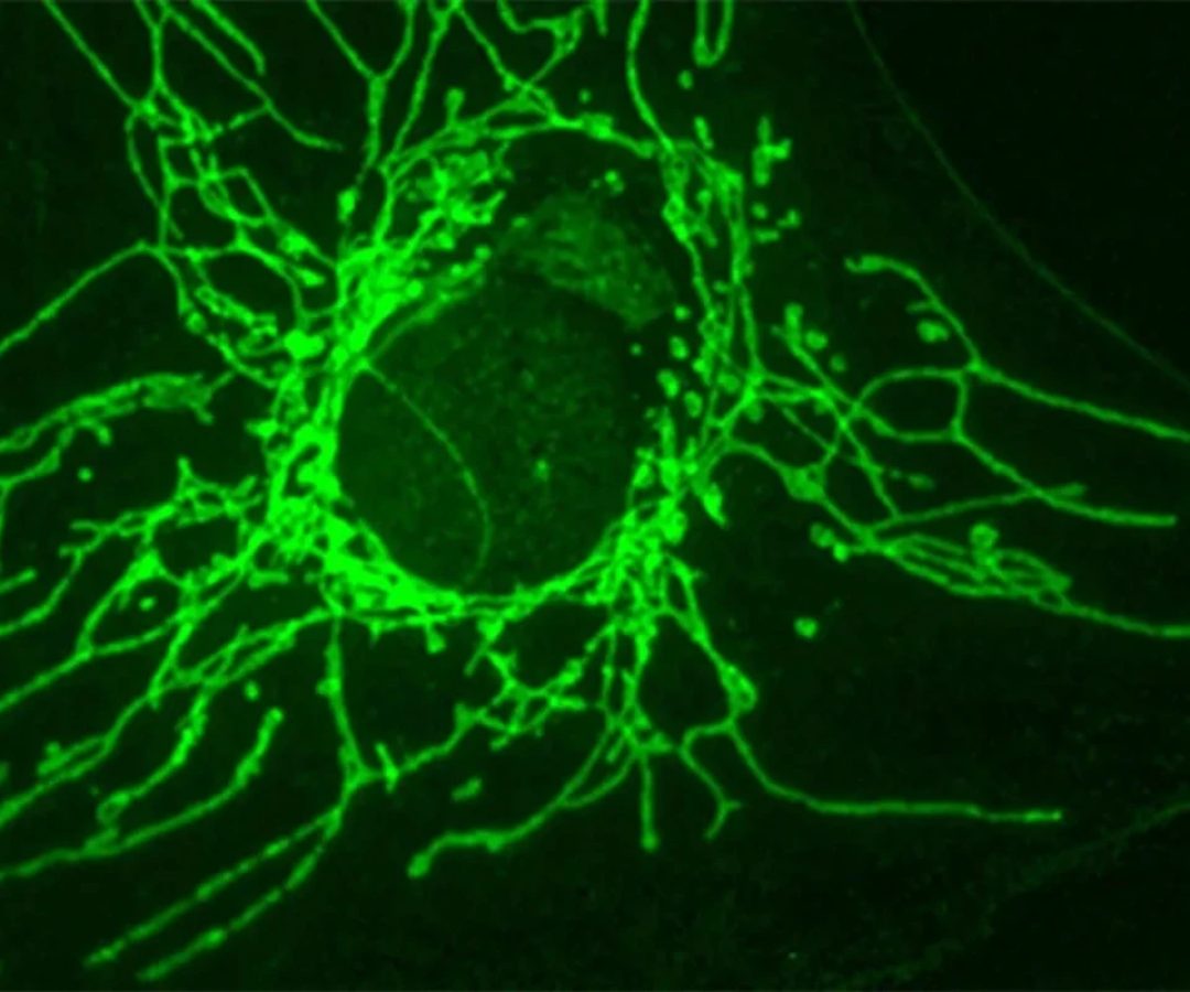 1 de 1 Célula cancerosa com mitocôndrias em verde — as centrais de energia da célula e locai...