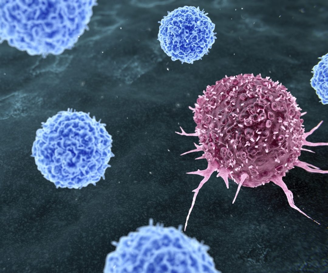 1 de 1 Ilustração representando a terapia com linfócitos infiltrantes de tumor (TIL) para o tr...