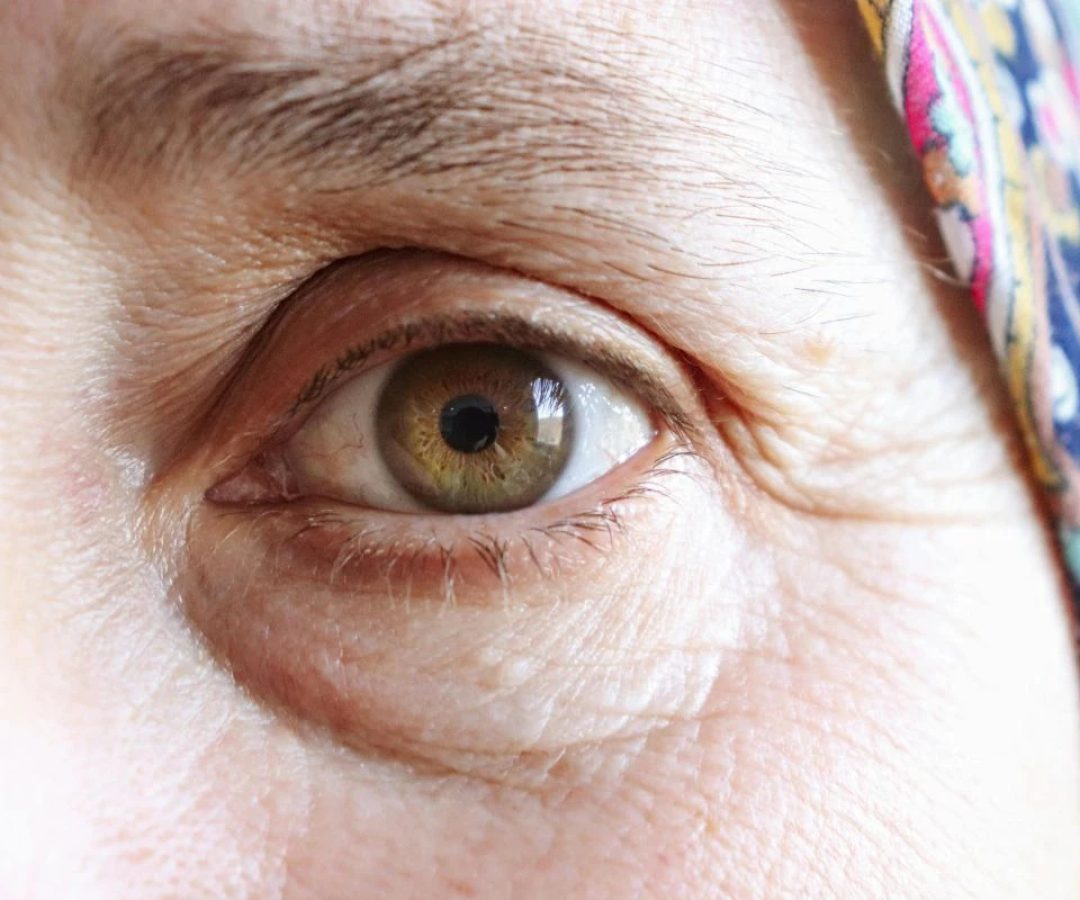 1 de 1 visão mulher / olhos - Foto: Canva