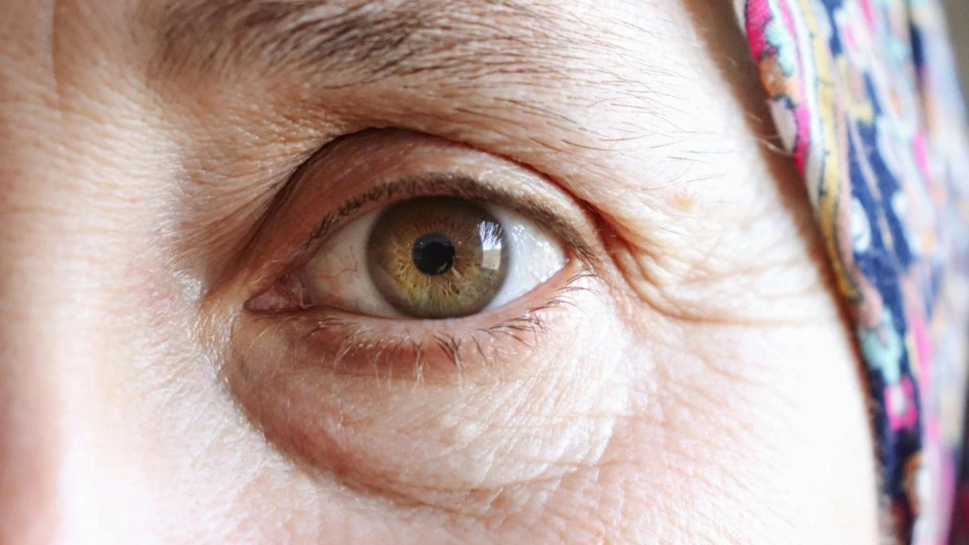 1 de 1 visão mulher / olhos - Foto: Canva